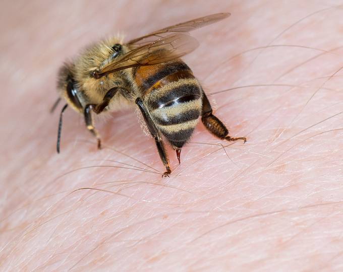 Что делать, если ребенка или взрослого укусила пчела/оса