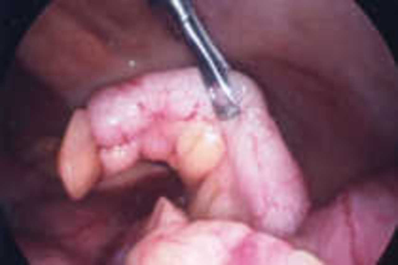 сперма во влагалище у детей фото 54